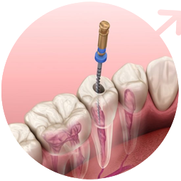 Conservative Dentistry & Endodontics